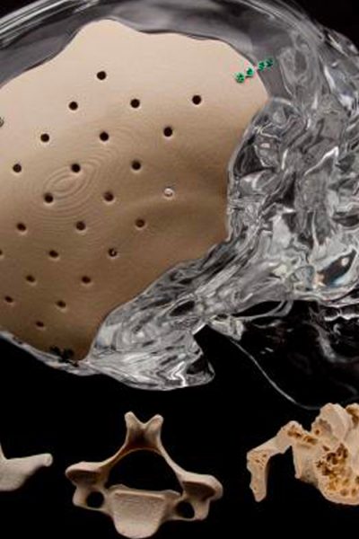 Ortopedi Alanında 3D Yazıcı ve Tarayıcıların Yeri