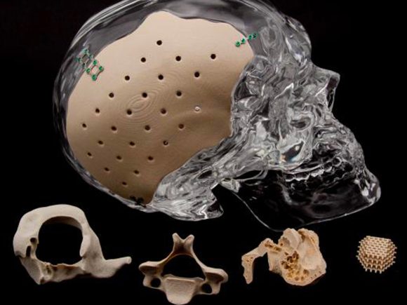 Ortopedi Alanında 3D Yazıcı ve Tarayıcıların Yeri