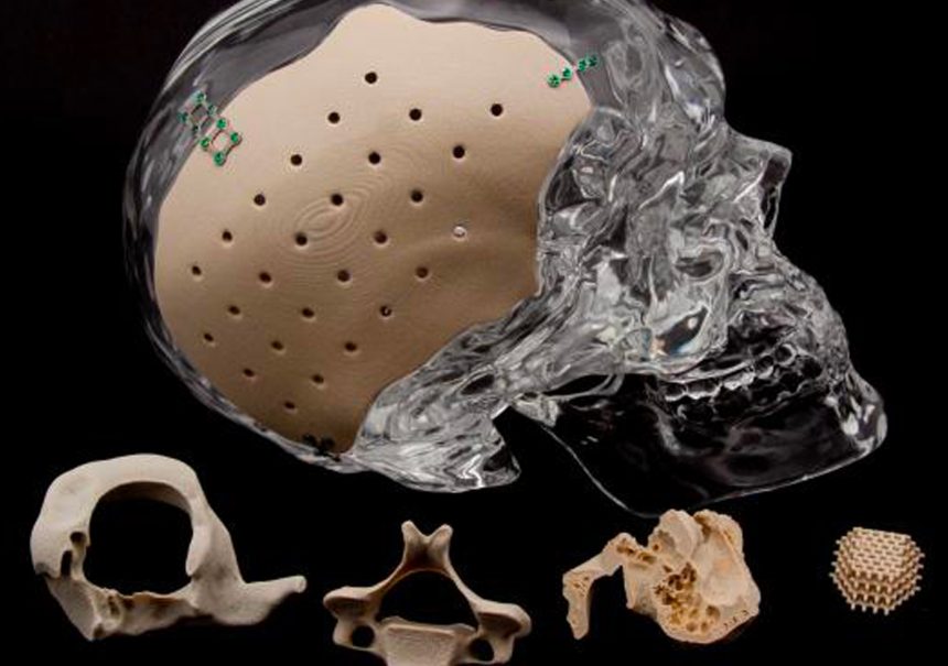 Ortopedi Alanında 3D Yazıcı ve Tarayıcıların Yeri