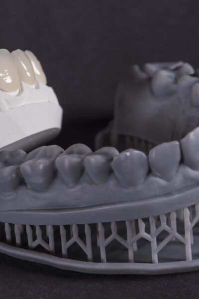 Diş Hekimliğinde Yenilikçi Bir Dönüşüm: Eklemeli İmalatın Etkisi